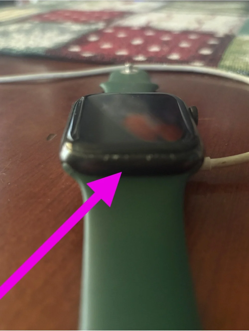 Apple Watch Series 7 - 45mm Aluminum Case, 7 Bands & Apple Charging Station
